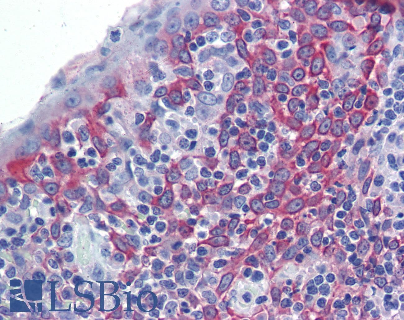 LIN7C / VELI3 Antibody (N-Terminus)