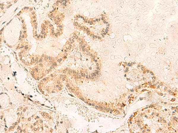 ZNF85 / HPF4 Antibody