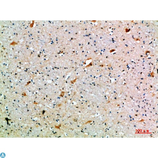 SEMA7A / Semaphorin 7A Antibody