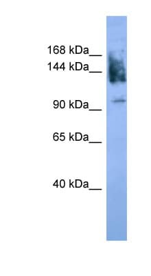 NCAM / CD56 Antibody (aa780-829)
