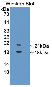 TRPV6 Antibody (aa578-725, Biotin)