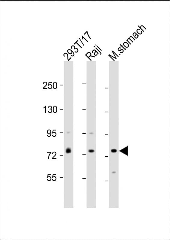PLA2G4F Antibody (Internal)