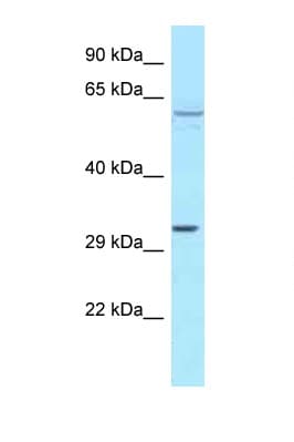 Polyclonal Rabbit anti-Human TBRG4 Antibody (aa323-372, WB)