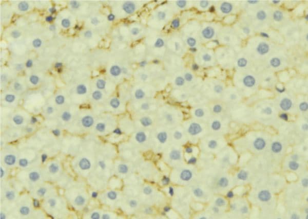 Polyclonal Rabbit anti-Human PSEN1 / Presenilin 1 Antibody (IHC, IF, WB)