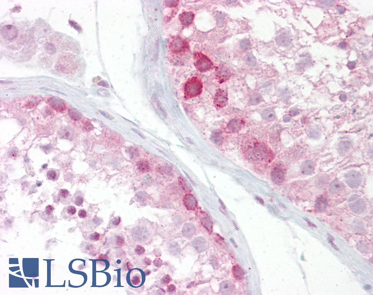 WNT2B Antibody (N-Terminus)