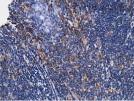 KHK / Ketohexokinase Antibody (clone OTI3D1)