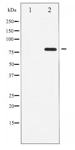 ATRIP Antibody (phospho-Ser68)