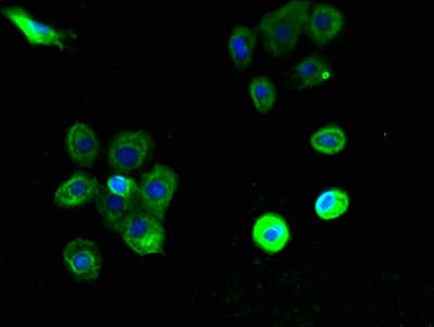 PTAFR / PAF Receptor Antibody