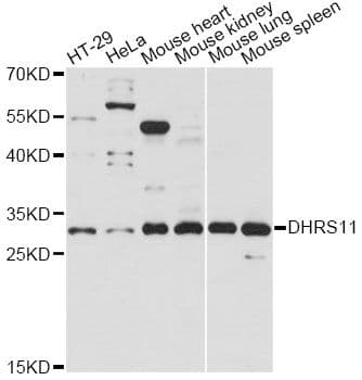 DHRS11 / MGC4172 Antibody