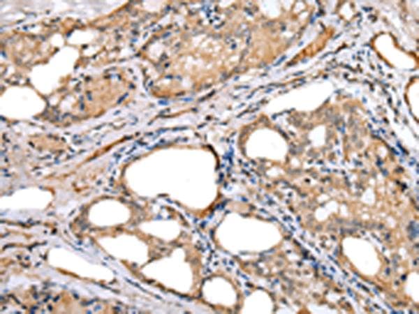 Polyclonal Rabbit anti-Human LRRC19 Antibody (IHC, WB)
