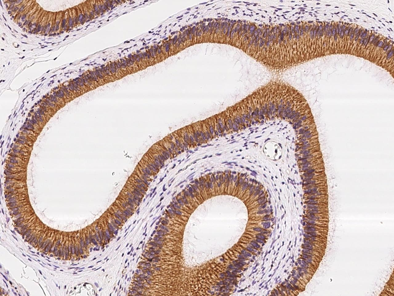 Polyclonal Rabbit anti-Human VPS45 Antibody (IHC)