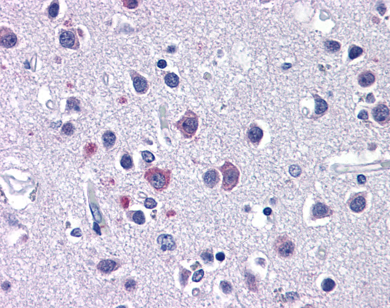 Polyclonal Rabbit anti-Human CACNA1I / Cav3.3 Antibody (aa755-804, IHC, WB)