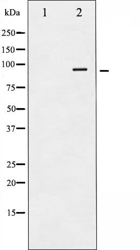 CALD1 / Caldesmon Antibody