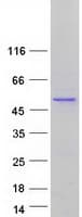 Human PDP2 Protein (Recombinant Myc-DDK (Flag))