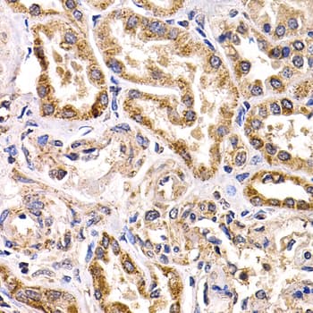 Polyclonal Rabbit anti-Human FZR1 Antibody (IHC, IF, WB)