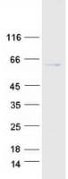 Human CDADC1 Protein (Recombinant Myc-DDK (Flag))