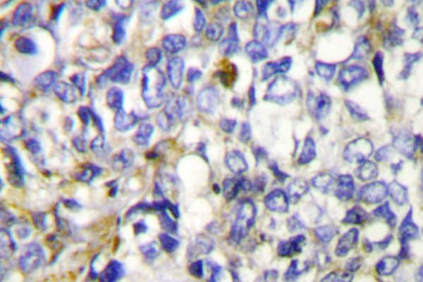 CYP27 / CYP27A1 Antibody (Glu131)