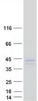 Human RWDD2B / C21orf6 Protein (Recombinant Myc-DDK (Flag))