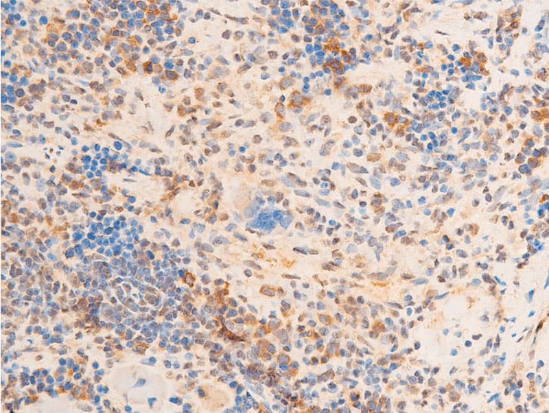 LMNA / Lamin A+C Antibody (phospho-Ser392)