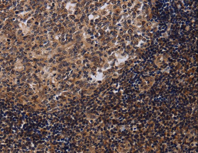 NTMT1 / C9orf32 Antibody
