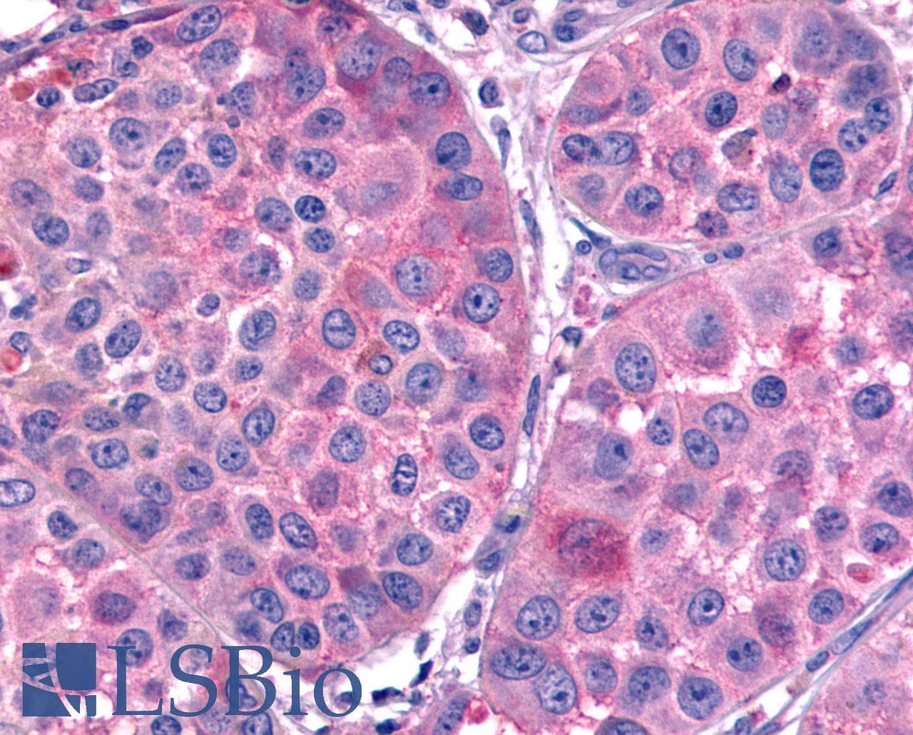 PathPlus™ Polyclonal Rabbit anti-Human FZD7 / Frizzled 7 Antibody (N-Terminus, IHC)