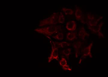 PHKA1 + PHKA2 Antibody