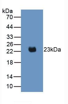 IL2 Antibody