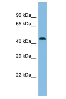 MBTD1 Antibody (aa120-169)