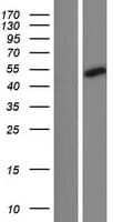 CCDC121 Protein (Over-Expression Lysate Myc-DDK (Flag))