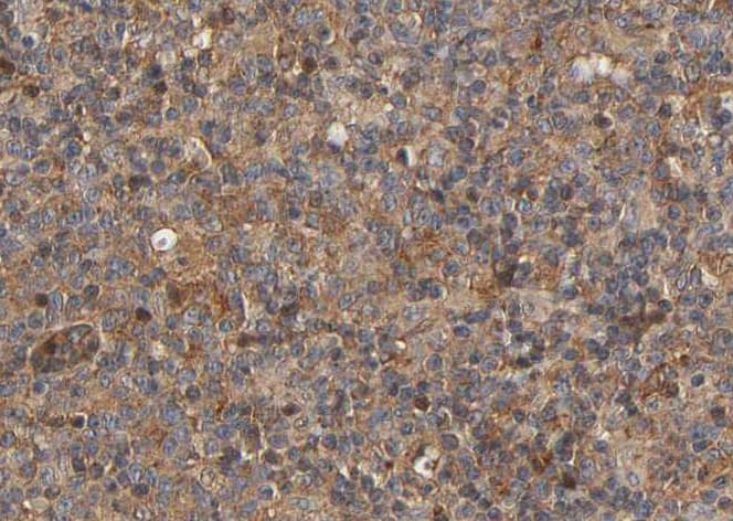MRC2 / Endo180 Antibody