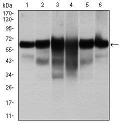 KRT5 / CK5 / Cytokeratin 5 Antibody (clone 2C2)