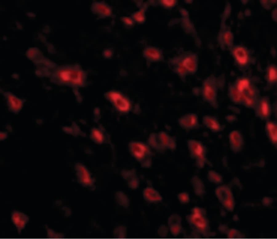 IHC-plus™ Polyclonal Rabbit anti-Human TTBK1 Antibody (IHC, IF, WB)
