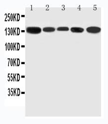 Polyclonal Rabbit anti-Mouse RGS3 Antibody (aa909-925, IHC, WB)