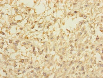 CCDC113 Antibody
