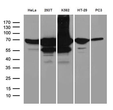 IMP-3 / IGF2BP3 Antibody (clone OTI4H5, Carrier-free)