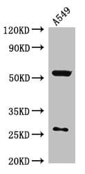 IOP1 / NARFL Antibody