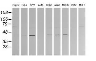 MAP2K1 / MKK1 / MEK1 Antibody (clone OTI3C1, Carrier-free)