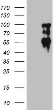 SOX6 Antibody (aa1-244, clone OTI5E4, Carrier-free)