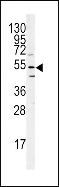 Polyclonal Rabbit anti-Human ATG14 Antibody (aa55-84, WB)