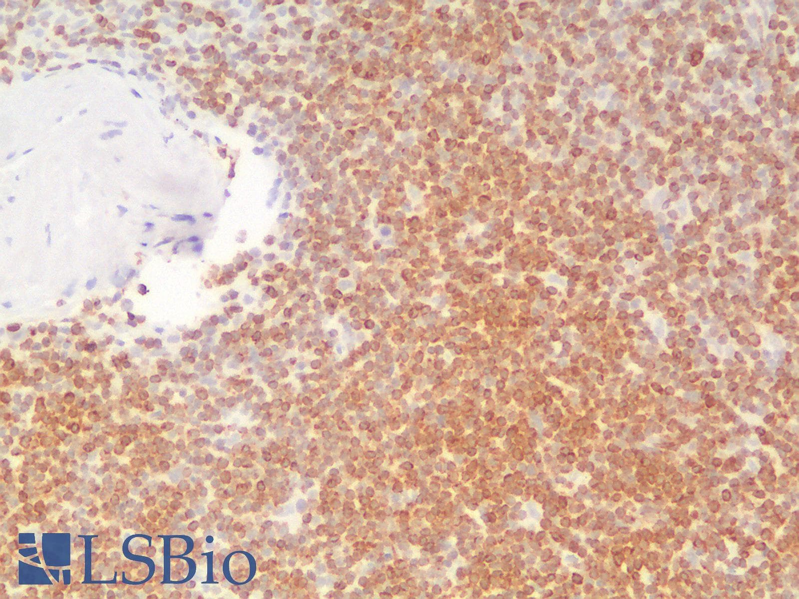 PathPlus™ BCL2 / Bcl-2 Antibody (clone BCL2/2210R)