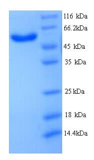 Human MICAL2 Protein (Recombinant His)