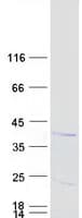 Human TYMSOS Protein (Recombinant Myc-DDK (Flag))