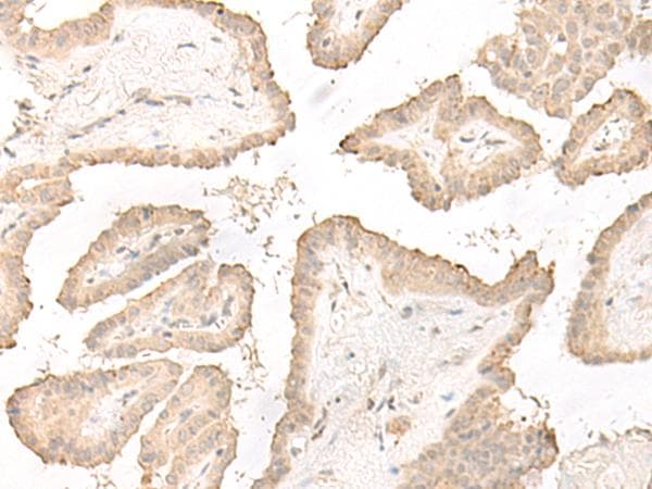 DCD / Dermcidin Antibody