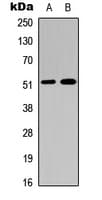 Polyclonal Rabbit anti-Human F9 / Factor IX Antibody (Internal, WB)