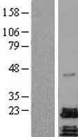 PACAP Protein (Over-Expression Lysate Myc-DDK (Flag))