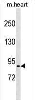 PRRT4 Antibody (aa524-552)
