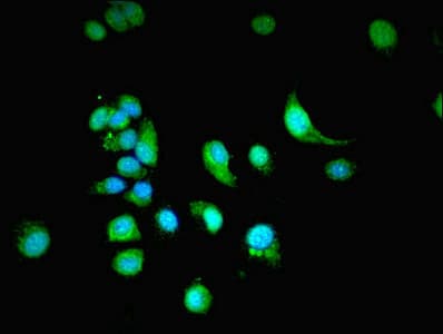 Polyclonal Rabbit anti-Human NXF3 Antibody (aa1-531, IHC)