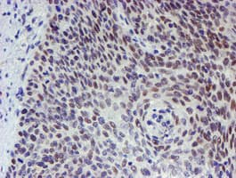 TPRKB Antibody (clone OTI3E3)