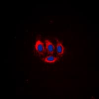 ETK / BMX Antibody (phospho-Tyr566)