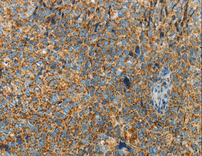 Polyclonal Rabbit anti-Human BCAT2 Antibody (IHC, WB)